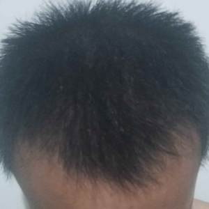 发际线分享社区