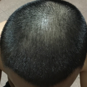 发际线分享社区