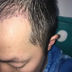 发际线分享社区
