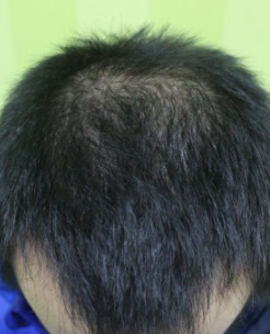 发际线分享社区