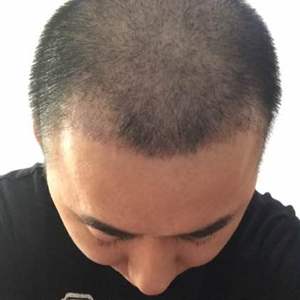 发际线分享社区