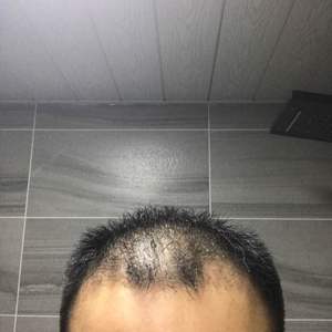发际线分享社区