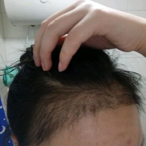 发际线分享社区