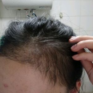 发际线分享社区