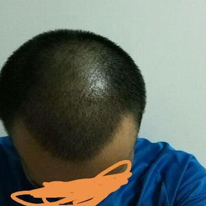 发际线分享社区