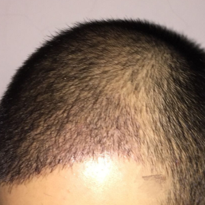发际线分享社区