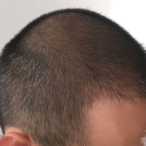 发际线分享社区