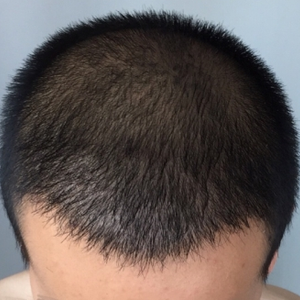 发际线分享社区