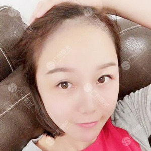 发际线分享社区