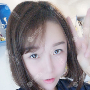 发际线分享社区