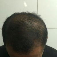 <font color="red">稀少加密</font>用戶圖片