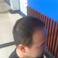 <font color="red">稀少加密</font>用戶圖片