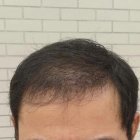 <font color="red">稀少加密</font>用戶圖片