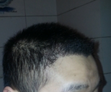 发际线分享社区