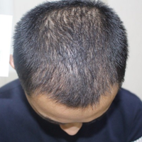 <font color="red">稀少加密</font>用戶圖片