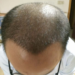 发际线分享社区