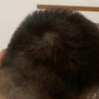 <font color="red">稀少加密</font>用戶圖片