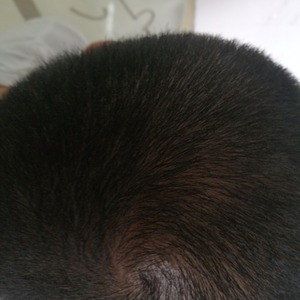 发际线分享社区