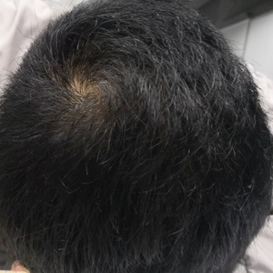 发际线分享社区