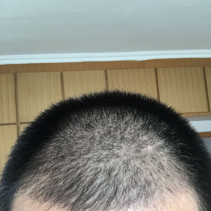 发际线分享社区