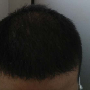 发际线分享社区