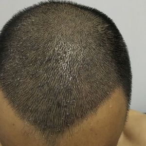 发际线分享社区