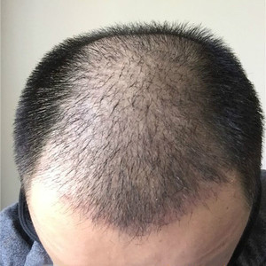 稀少加密分享社区