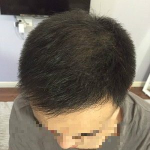 发际线分享社区
