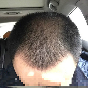 稀少加密分享社区