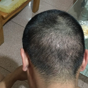 发际线分享社区