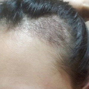 发际线分享社区