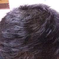 <font color="red">稀少加密</font>用戶圖片