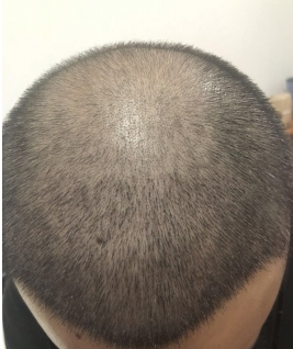 发际线分享社区
