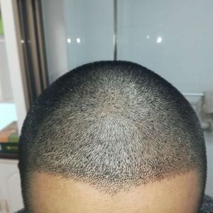 发际线分享社区