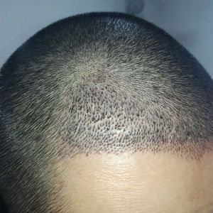 发际线分享社区
