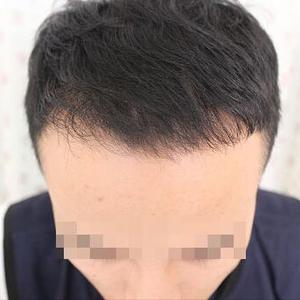 发际线分享社区