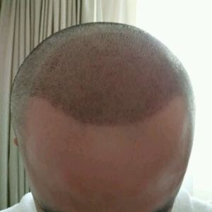 发际线分享社区