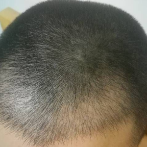 发际线分享社区