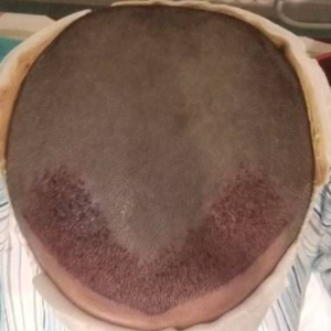 发际线分享社区