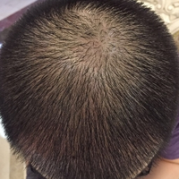 <font color="red">稀少加密</font>用戶圖片
