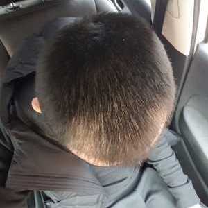 发际线分享社区