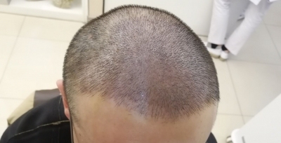 发际线分享社区