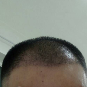 发际线分享社区