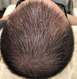 发际线分享社区
