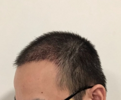 发际线分享社区