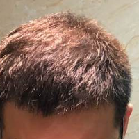 <font color="red">稀少加密</font>用戶圖片