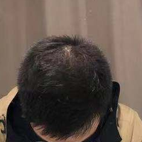 <font color="red">稀少加密</font>用戶圖片