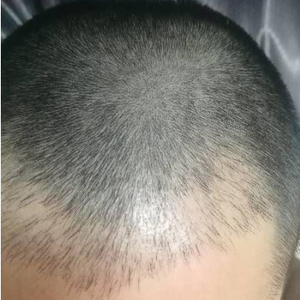 发际线分享社区