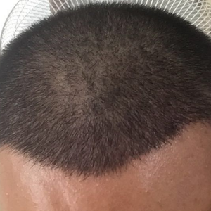 发际线分享社区