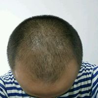 <font color="red">稀少加密</font>用戶圖片